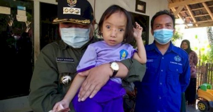 Awal Juni ini Pemerintah Kabupaten (Pemkab) Garut mencanagkan Bulan Pencarian Stunting sebagai bagian dari gerakan besar dalam menangani angka stunting di wilayah tersebut. (humas pemkab garut)